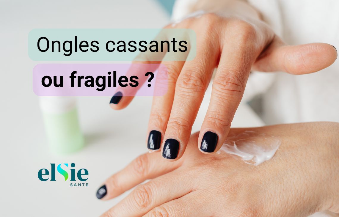 Tout savoir sur la santé de vos ongles