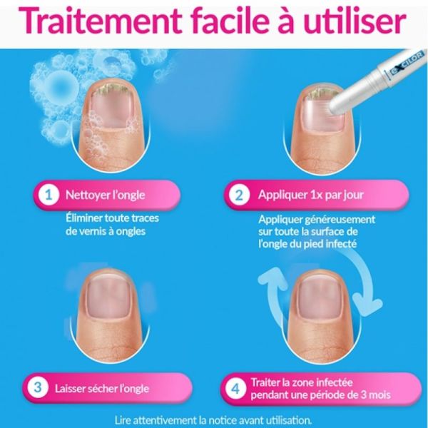 Excilor Easy traitement mycose de l'ongle Stylet 4ml