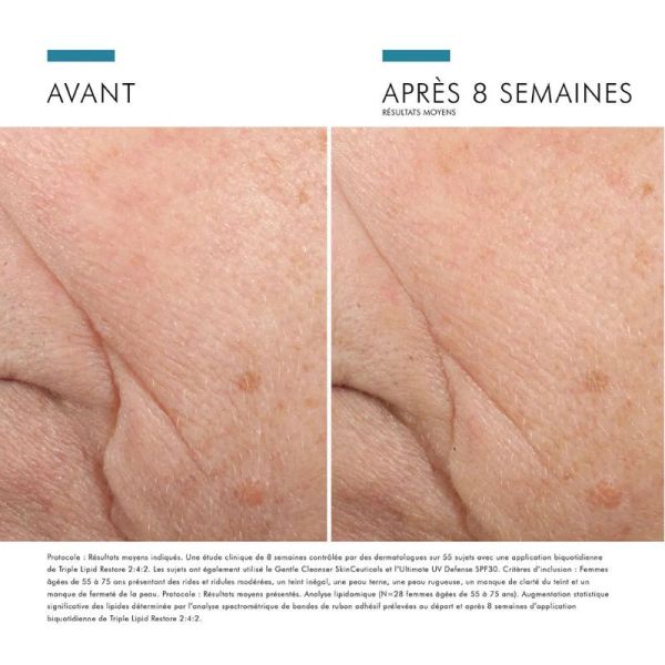 Skinceuticals Correct Triple Lipid Restore 2:4:2 48 ml