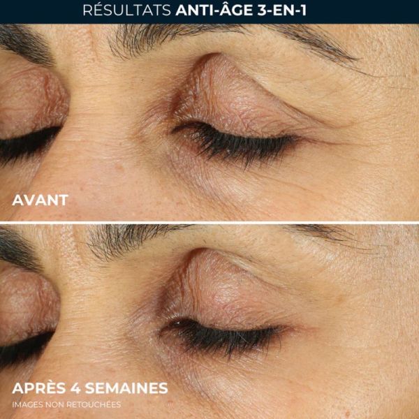 ROC Retinol Correxion soin lissant crème yeux 15ml