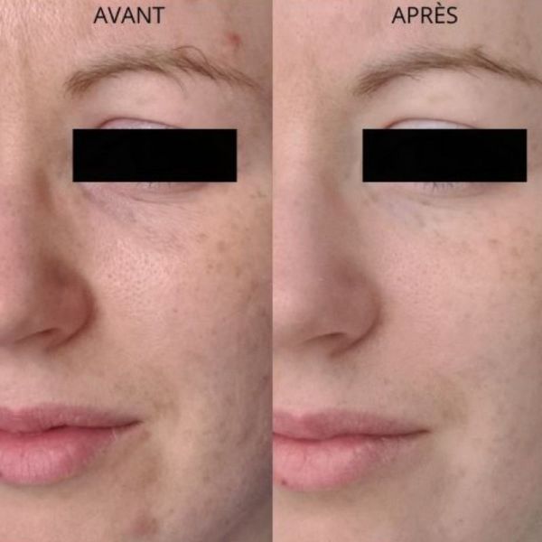 Algologie Elixir De L'Archipel sérum anti Imperfections 30ml