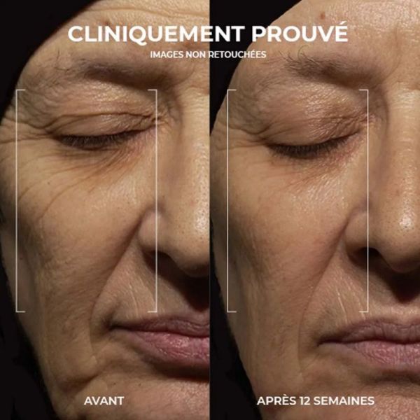 Roc Retinol Correxion rides crème de nuit 30ml