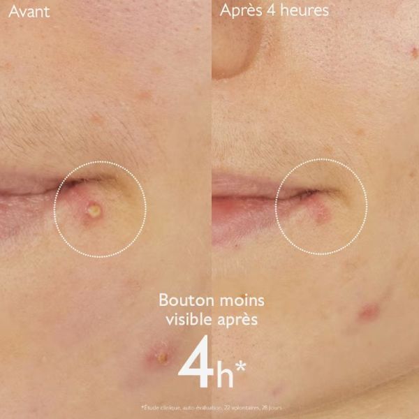 Caudalie Vinopure stop boutons salicylique 15ml