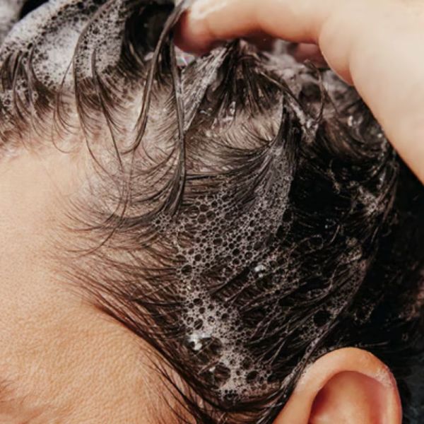 Horace shampoing antipelliculaire doux 250ml