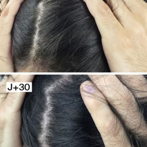 Horace shampoing antipelliculaire doux 250ml