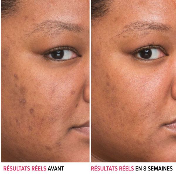 IT Cosmetics Bye Bye Dark spots sérum anti tâches au niacinamide 30ml