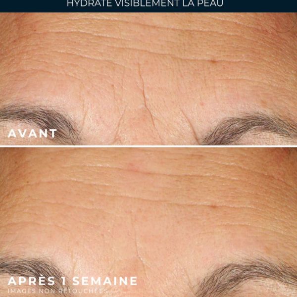 RoC Multi Correxion hydrater + repulper capsules sérum 30 capsules