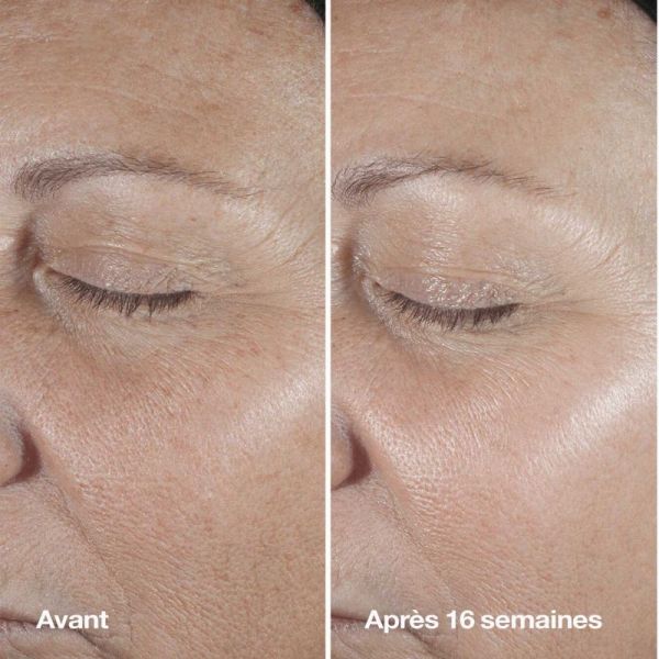 Clinique Smart Clinical Repair™ sérum correcteur anti-rides 50ml