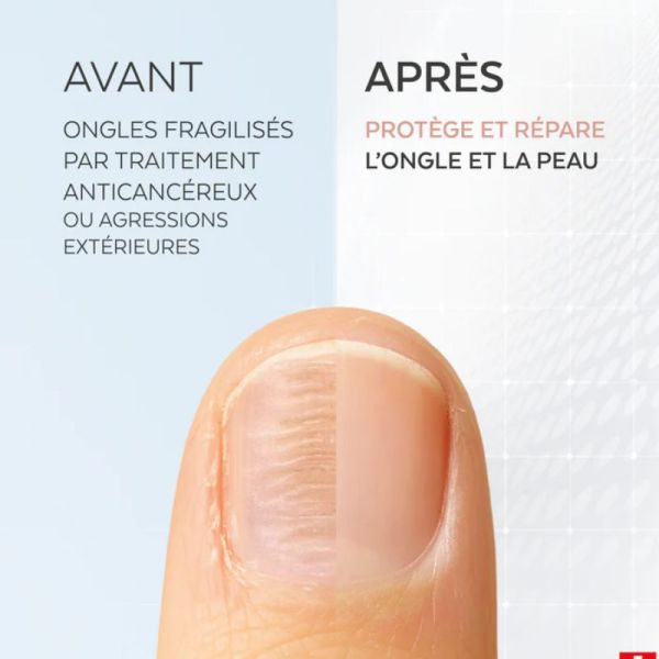 Poderm sérum ongles fragilisés 8ml