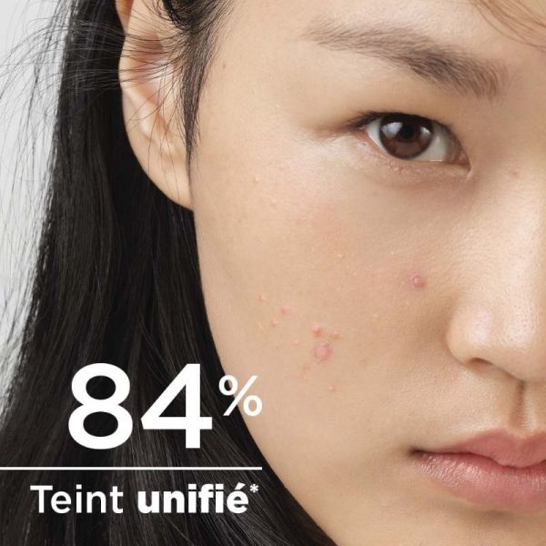 Bioderma Sébium Global Cover soin intense purifiant teinté peaux acnéique 30ml