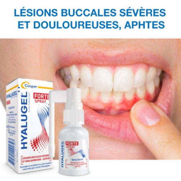 Hyalugel Forte spray lésions buccales 20ml