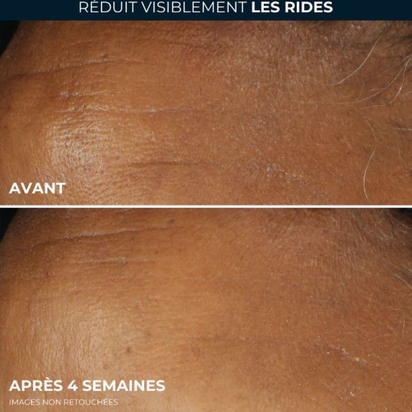 Roc Correction rides hydratant quotidien SPF30 30ml