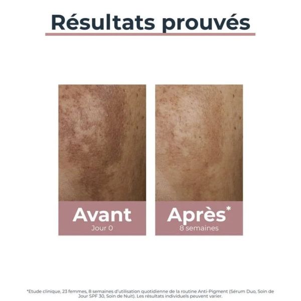 Eucerin Anti-Pigment sérum duo 30ml