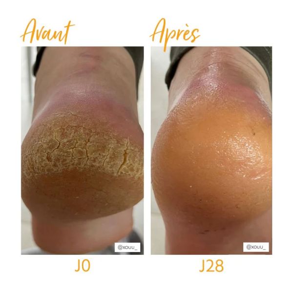 Alvadiem onguent réparateur irritations gerçures à la gelée royale 50ml