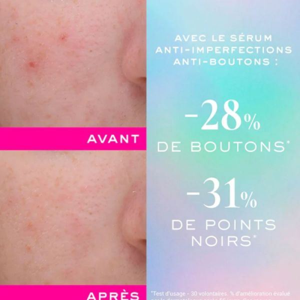 Nuxe Zinc Power sérum anti imperfections anti boutons 30ml