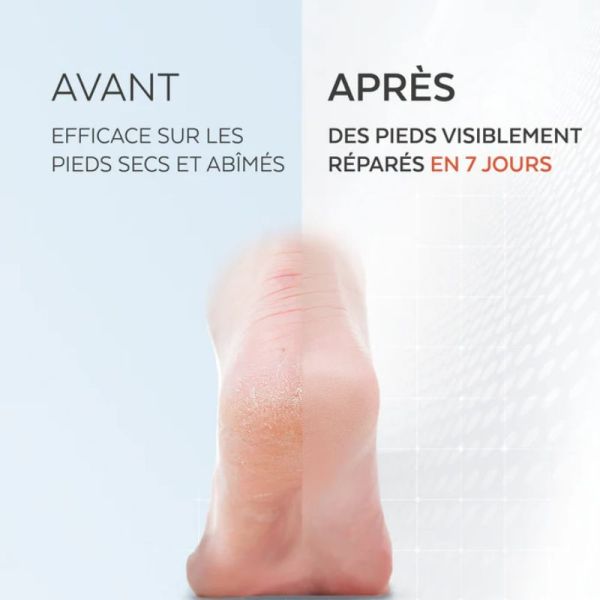 Poderm sérum pieds secs abîmé 75ml