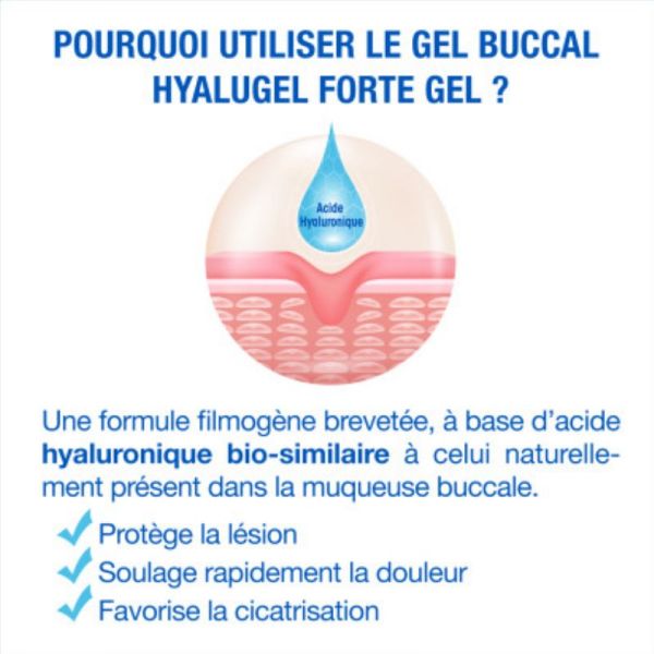 Hyalugel Forte gel buccal 8ml