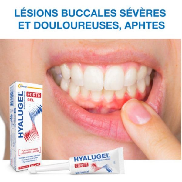 Hyalugel Forte gel buccal 8ml