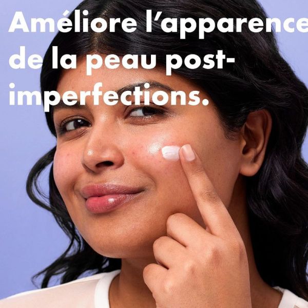 Hero Rescue Balm Original baume post imperfections 15ml