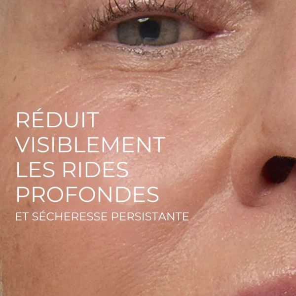 RoC Retinol Correxion correction rides crème riche 50ml