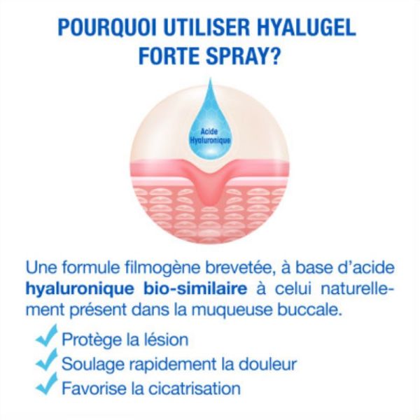 Hyalugel Forte spray lésions buccales 20ml