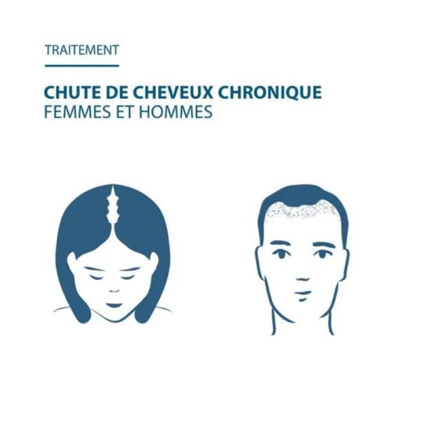 Ducray Anacaps expert chute cheveux chronique 90 gélules