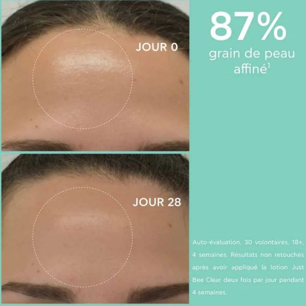 Apivita Just Bee Clear lotion purifiante réductrice de pores 200ml