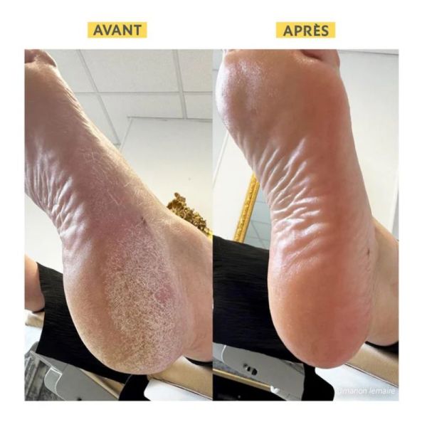 Alvadiem onguent réparateur irritations gerçures à la gelée royale 50ml