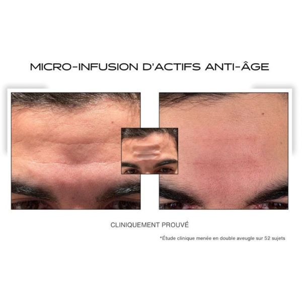 Goodlifescience patch anti-âge - 900 micro-cônes 8 patchs