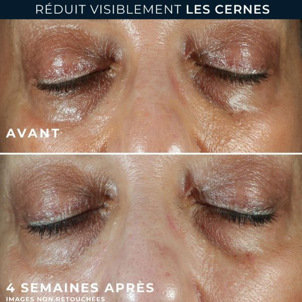 Roc Unifier + Lifter crème contour yeux lift & cernes 15ml