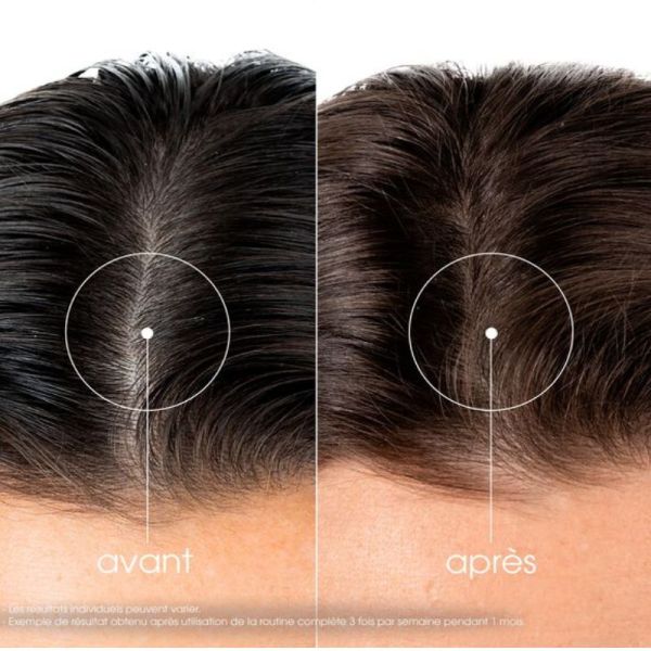 Klorane Antichute shampooing à la quinine et Edelweiss 400ml