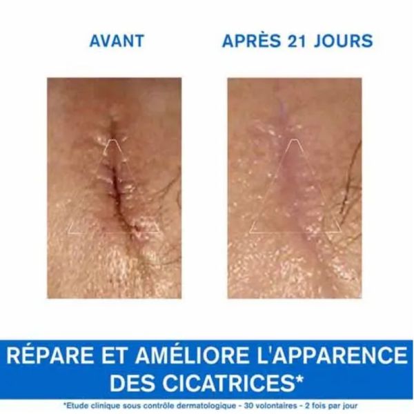 Uriage Bariéderm cica crème réparatrice peaux fragilisees 100ml