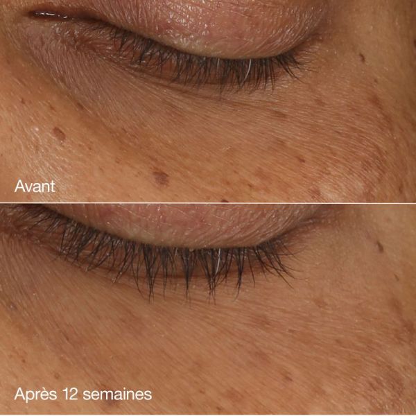 Clinique All about eyes sérum yeux concentré illuminateur 10ml