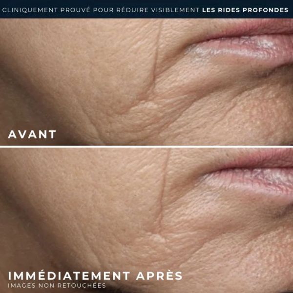 RoC Retinol Correxion correction rides crème riche 50ml