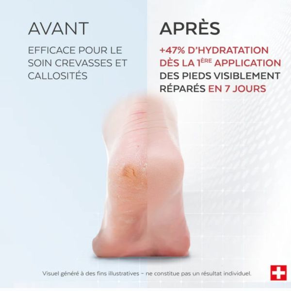 Poderm soin intensif nuit crevasses et callosités 75ml